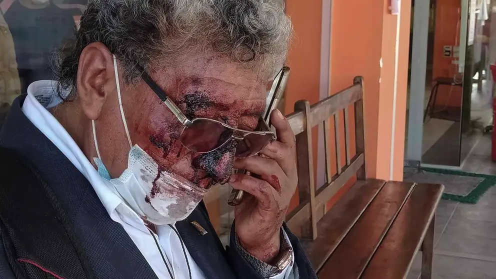 José Luis Funes aguarda la valoración médica en puertas del IDIF de Coña Coña, en Cochabamba. DICO SOLÍS