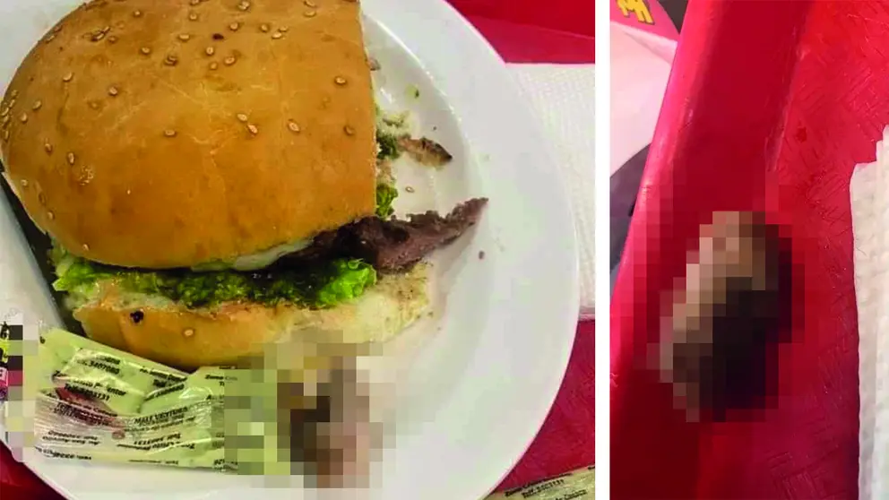 Dedo hallado en hamburguesa pertenec&iacute;a a empleado que se accident&oacute; al preparar la carne. RRSS