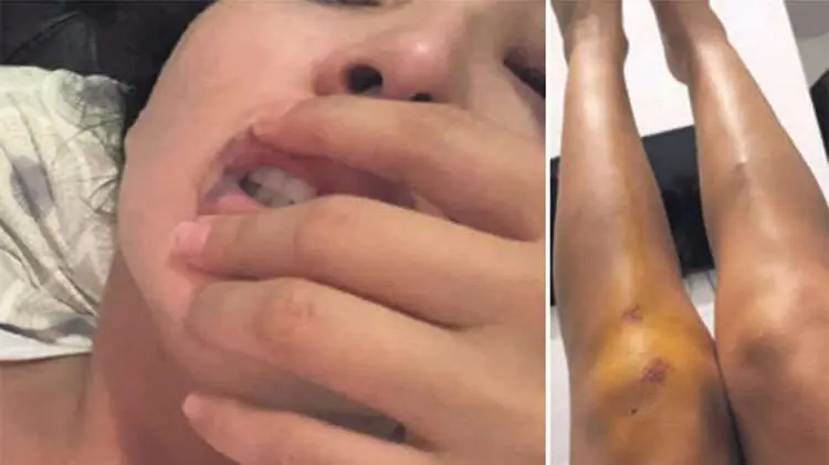 La mujer denunciante de violencia de g&eacute;nero. Urgente