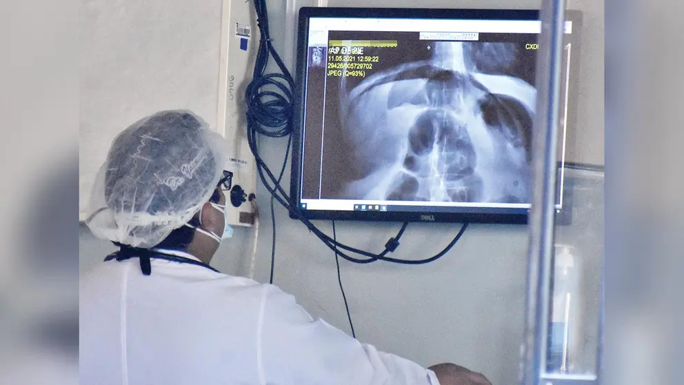 Un médico observa una radiografía del pulmón de un paciente en terapia intensiva. DICO SOLÍS