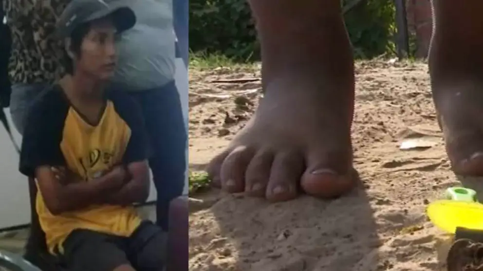 El agresor del ni&ntilde;o de 3 a&ntilde;os fue aprehendido. Foto: UNITEL