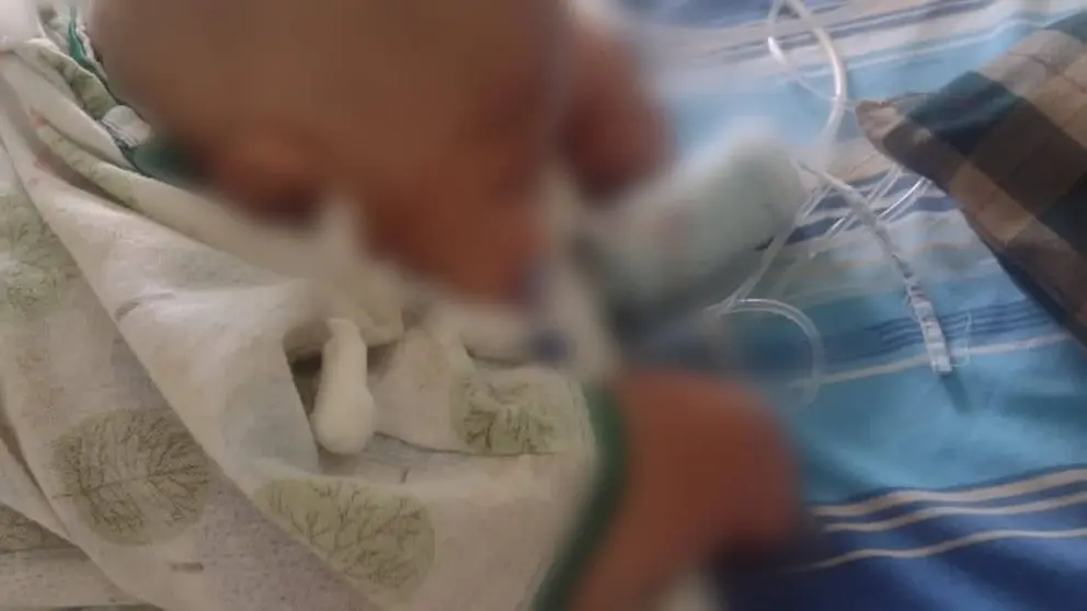 Uziel, el beb&eacute; que tiene obesidad m&oacute;rbida y necesita ayuda de la poblaci&oacute;n. GENTILEZA FAMILIA ALBORTA