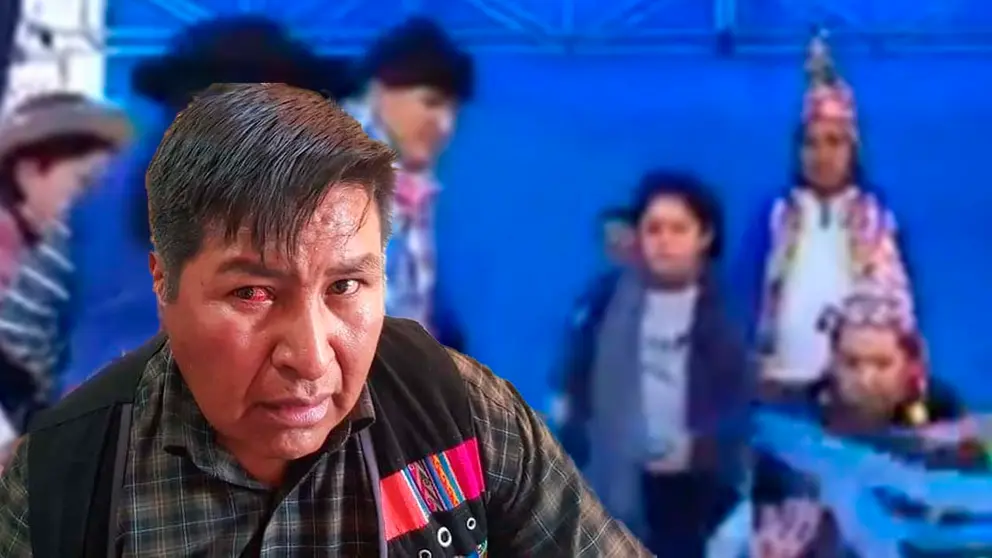El funcionario muestra el golpe que recibi&oacute; en su ojo. Gentileza La Patria