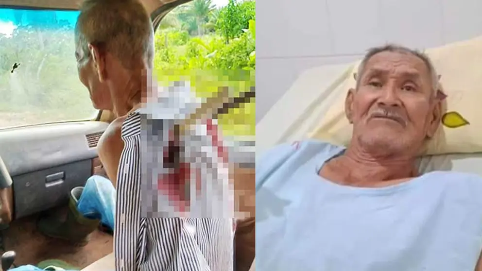 Alcides Mariategui sobrevivi&oacute; m&aacute;s de 8 horas con dos cuchillos en su espalda. FACEBOOK