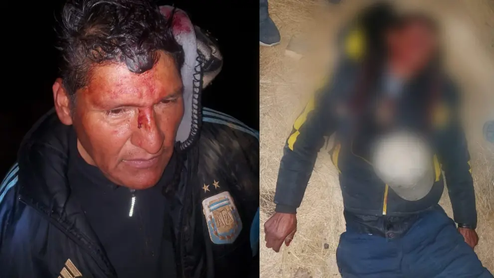 Comunarios de Cocapata, heridos tras enfrentamientos con mineros presuntamente ilegales. OPINI&Oacute;N