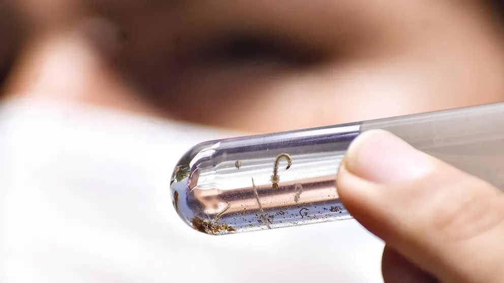 Imagen referencial de larvas del mosquito del dengue./ ARCHIVO