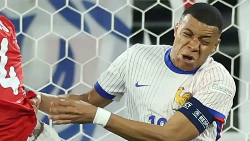 Kylian Mbapp&eacute; tendr&iacute;a la nariz fracturada. CRACKS.