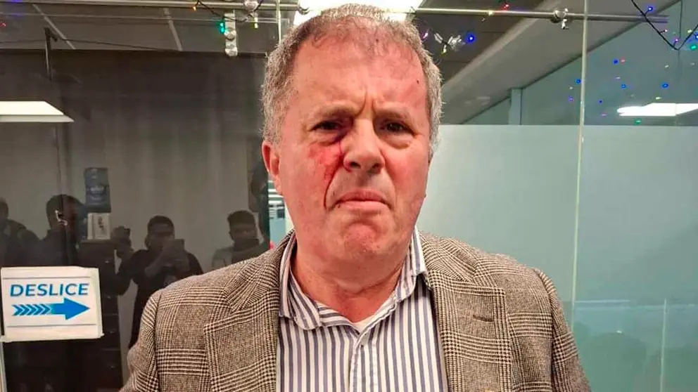 Foto de la agresi&oacute;n al diputado Roca.