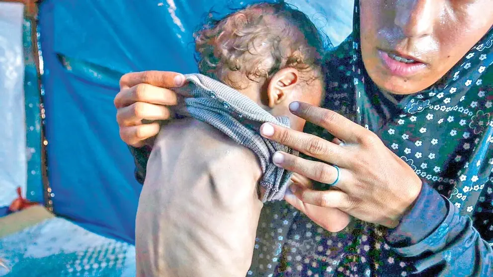 Una madre palestina muestra a su hijo desnutrido, en la Franja de Gaza./ UNRWA