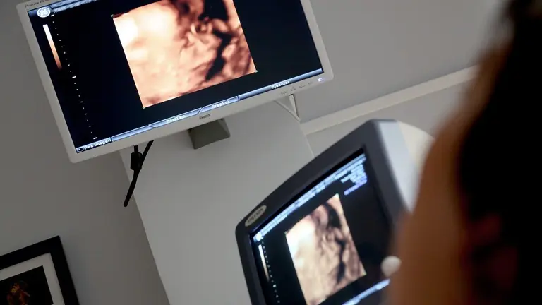ecografia-fetal
