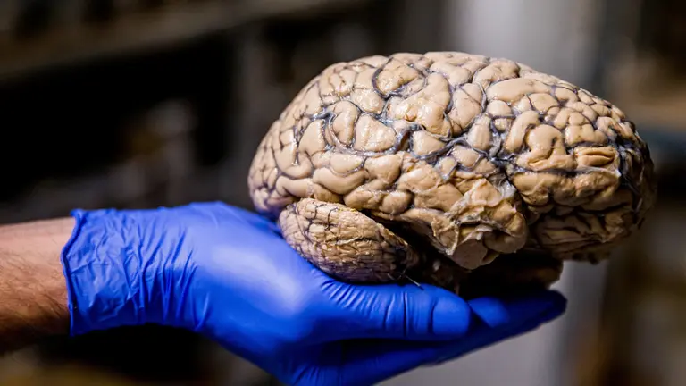 Cient&iacute;ficos estudian el cerebro humano y su reacci&oacute;n a los ruidos para prevenir el alzheimer. EFE