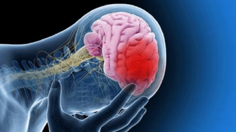 cerebro