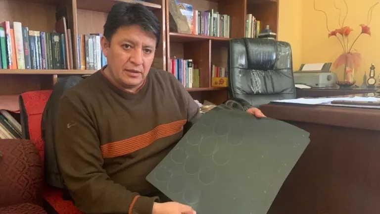 Eduardo M&eacute;rida muestra una radiograf&iacute;a de su esposa.