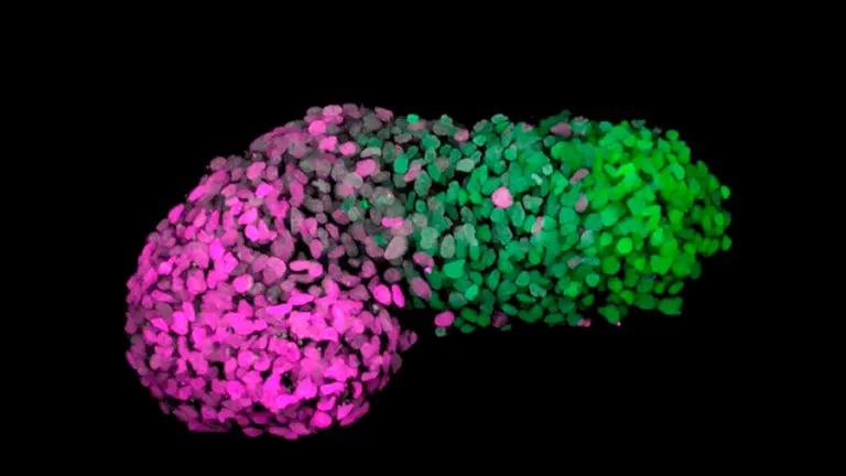 Un gastruloide humano desde un patr&oacute;n 'anteroposterior'. El verde marca la parte posterior que es similar al extremo de la cola de un embri&oacute;n y el magenta marca la parte anterior que es similar a las c&eacute;lulas del coraz&oacute;n en desarrollo. Un equipo internacional de cient&iacute;ficos ha generado, a partir de c&eacute;lulas madre humanas, un modelo similar al de un embri&oacute;n humano que recrea las primeras etapas del desarrollo embrionario y que, por tanto, ser&aacute; de gran ayuda para investigar el origen de algunas malformaciones y observar el desarrollo de muchas enfermedades. EFE
