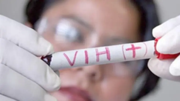 Imagen referencial sobre el VIH. ARCHIVO