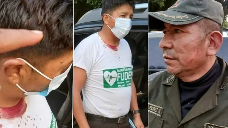 Una imagen referencial de oficiales agredidos. Clave 300