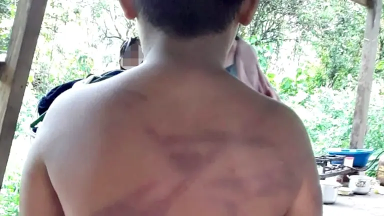 Las marcas de los golpes en la espalda del niño. FELCV 