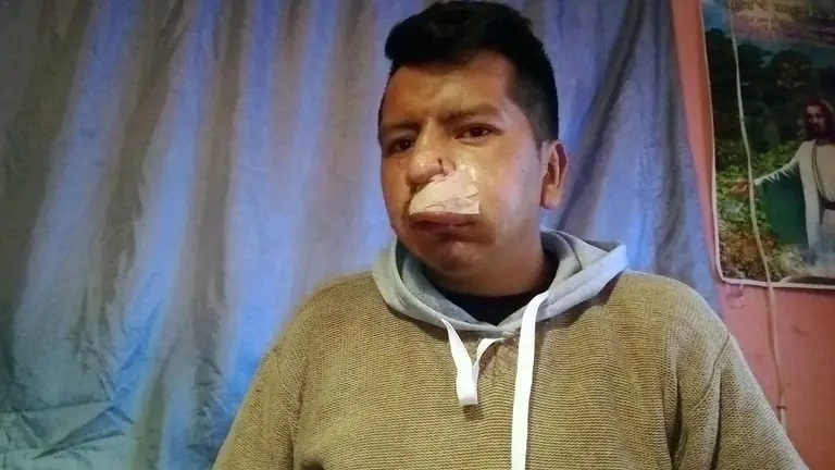 PERIODISTA HERIDO