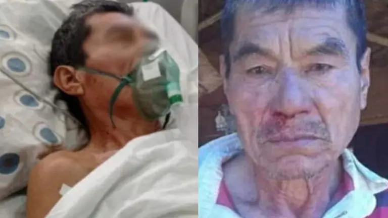 Fallece ind&iacute;gena que fue herido durante enfrentamientos en San Ignacio de Velasco. Foto: Urgente.bo
