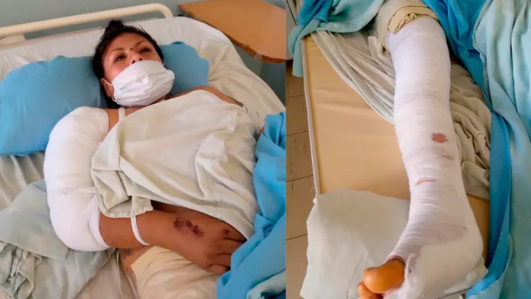 La joven madre en una cama de hospital tras el accidente. OPINI&Oacute;N