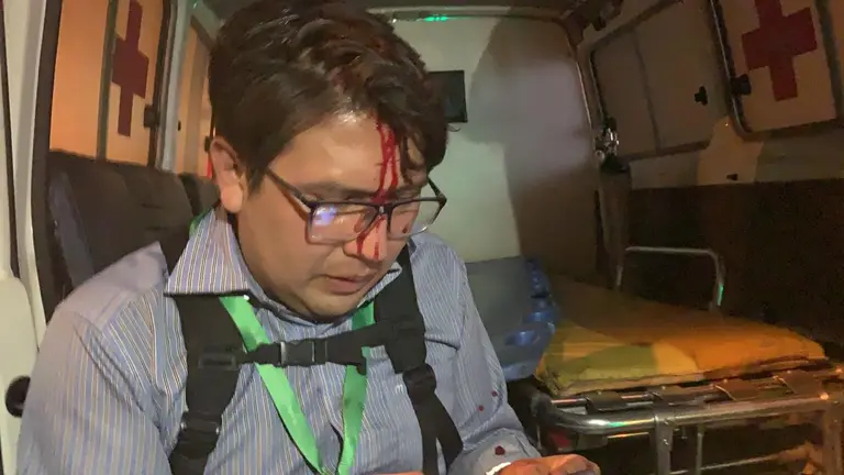 El periodista Humberto Ayllón result&oacute; herido durante los conflictos de 2019 en Cochabamba.
