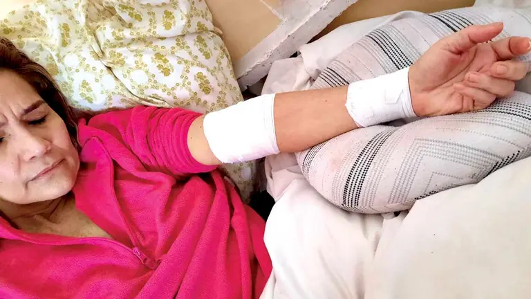La última foto de Jeanine Áñez, recuperándose de las heridas. RRSS