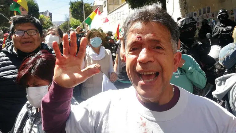 El activista del 21F muestra la sangre que le quedó en la mano, tras limpiarse la frente. URGENTE