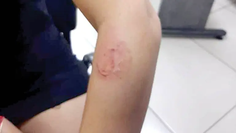 Uno de los brazos de la víctima. RRSS