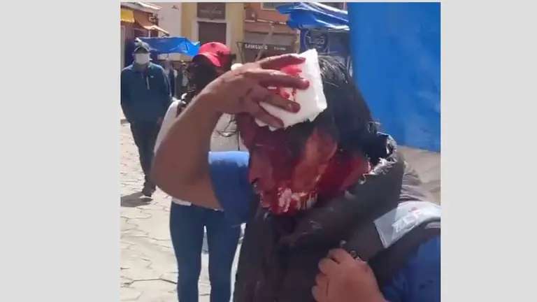 Una persona herida, tras los enfrentamientos en potos&iacute;