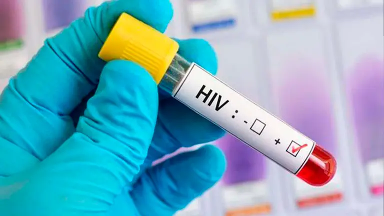 Imagen referencial de una prueba de VIH. Gentileza iStock