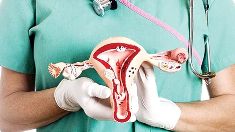 Imagen referencial sobre el cáncer de cuello uterino.       CAPTURA