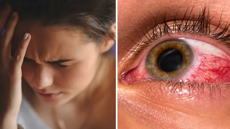 Una imagen referencial de una persona con problemas oculares. SALUD 180