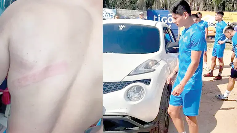 Una imagen de la agresión que sufrió Fernando Arismendi y lo ocurrido en la sede de Blooming. EL DEBER