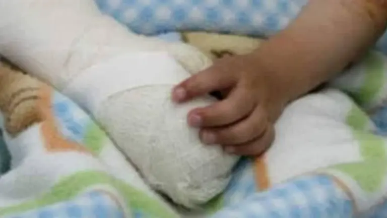 Imagen referencial de un ni&ntilde;o con lesiones./ ARCHIVO