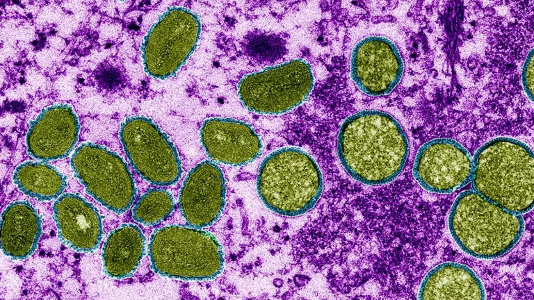 Muestra del virus de la viruela mono  bajo el lente de un microscopio electr&oacute;nico. Foto: CDC / Cynthia S. Goldsmith / Science
