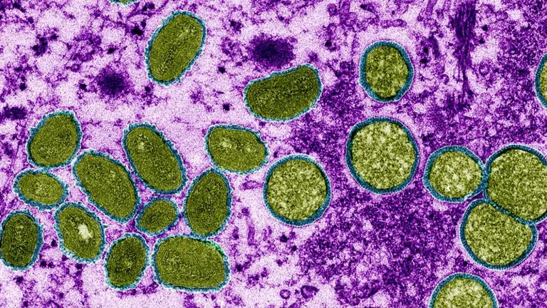 Muestra del virus de la viruela mono bajo el lente de un microscopio. CDC