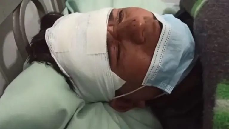 El periodista Mario Rocabado fue ingresado a un hospital por las agresiones. UNITEL