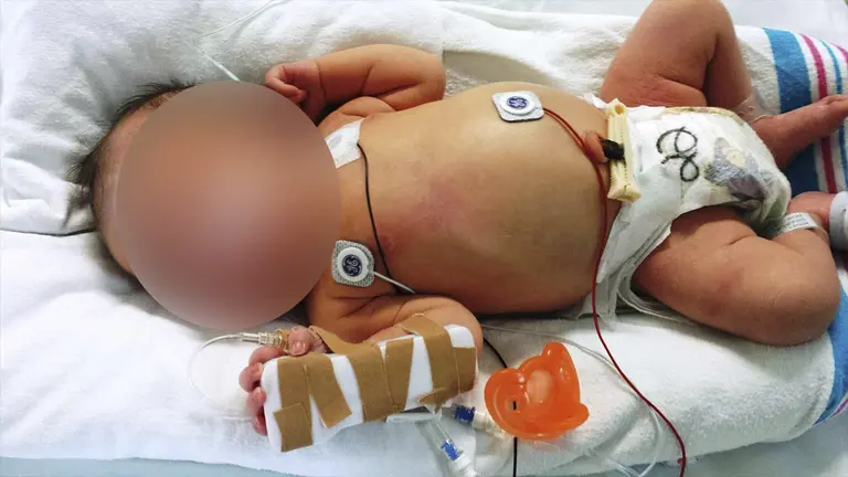 Sobre problemas respiratorios. EFE