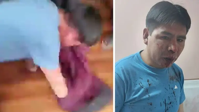 Abelardo Colque, presidente de la Brigada Parlamentaria Potos&iacute;, result&oacute; agredido brutalmente. RRSS
