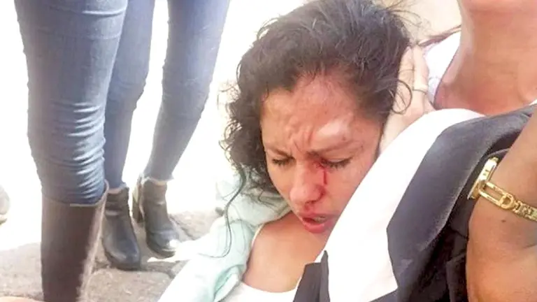 La asambleísta Muriel Cruz luego de ser agredida./ AGENCIAS