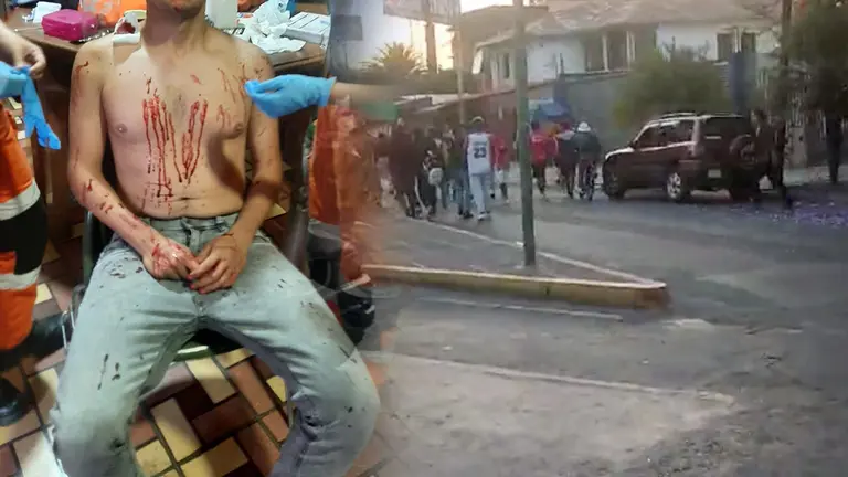 Cl&aacute;sico manchado: bombero de Aurora fue atacado por hinchas; le robaron el celular y lo golpearon