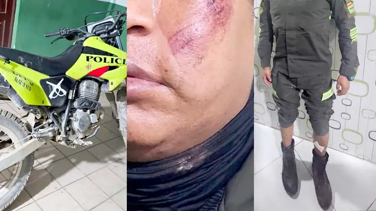 Policías son golpeados tras atender un caso de violencia./ POLICÍA