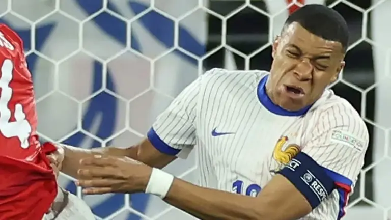 Kylian Mbapp&eacute; tendr&iacute;a la nariz fracturada. CRACKS.