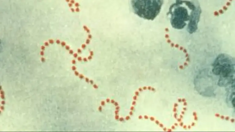Representaci&oacute;n gr&aacute;fica de la bacteria Streptococcus Pyoges./ 20MINUTOS.ES