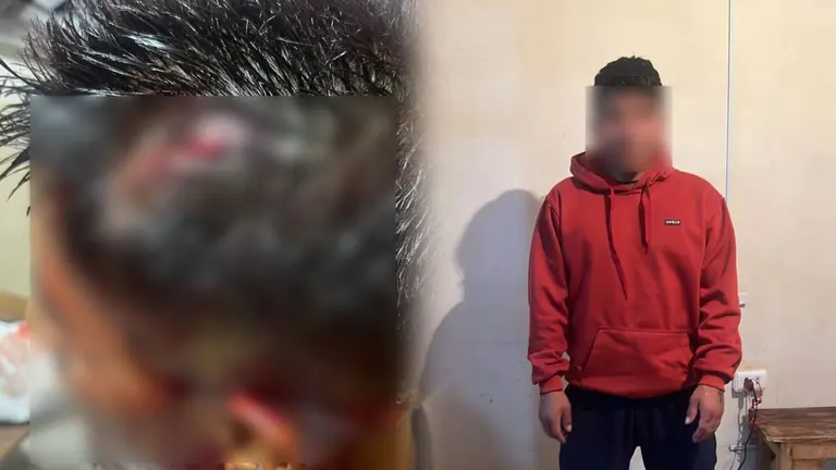 Fotograf&iacute;a que muestra al interno herido y al presunto responsable, quien fue aislado. CORTES&Iacute;A