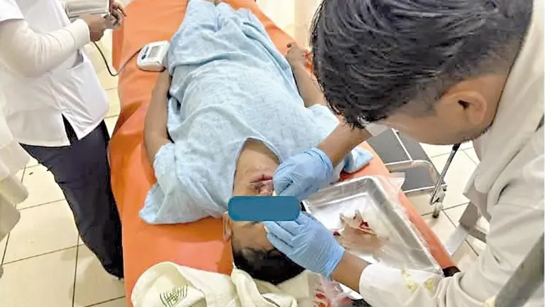 Polic&iacute;a herido durante emboscada en el Tr&oacute;pico./ CORTES&Iacute;A